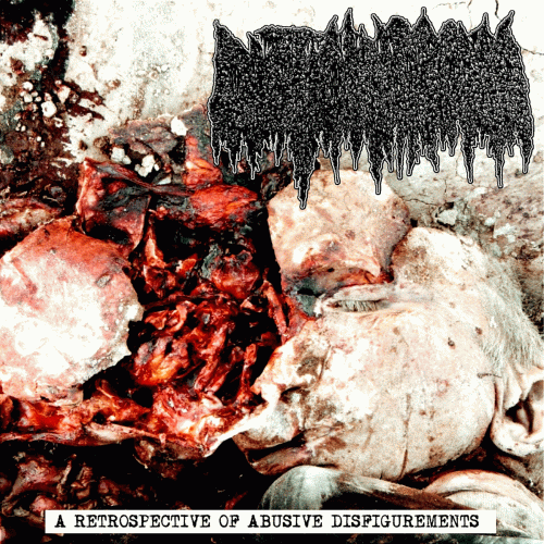 Cystic Hygroma : ​A Retrospective of Abusive Disfigurements